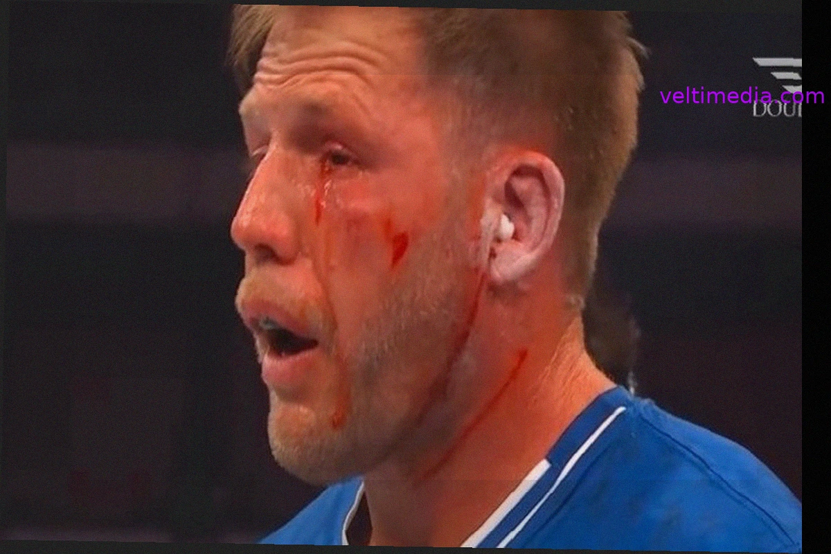 Jake Hager Injured in Power Slap Match